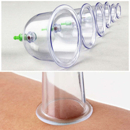 Acupuncture and Body Care Set with Cupping Tools