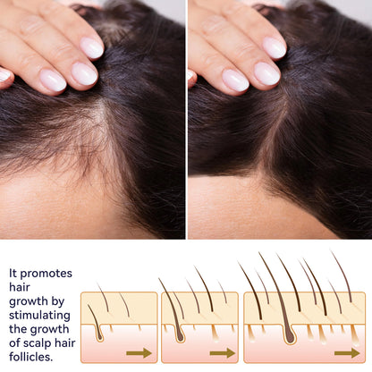 OUHOE Strong Hold Hair Spray for Damaged Hair Repair